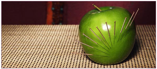 acupuncture